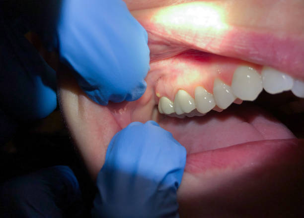 Best 24-Hour Emergency Dentist in Rosenberg, TX