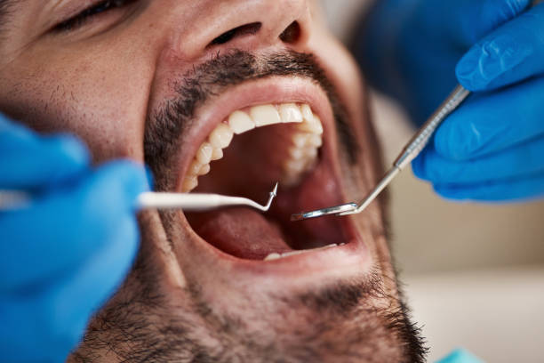Best Orthodontic Emergency Dentist in Rosenberg, TX