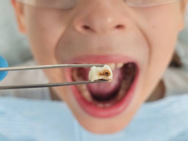 Best Emergency Cosmetic Dentistry in Rosenberg, TX