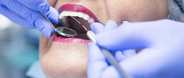 Best Emergency Dental Care for Abscessed Tooth in Rosenberg, TX