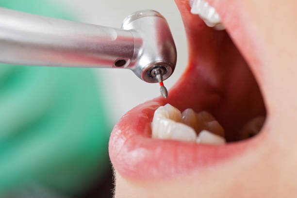 Best Weekend Emergency Dentist in Rosenberg, TX